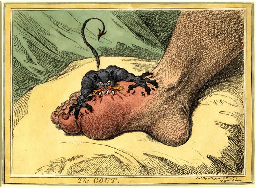 Gillray Observed　James Gillray　ジェームズギルレイ James Gillray: The Gout